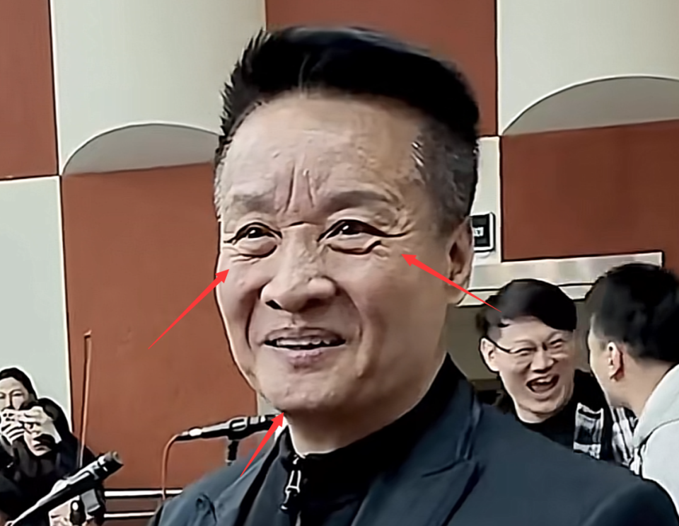 66岁阎维文近照曝光,满脸皱纹变化大,为照顾患癌妻子苍老太多