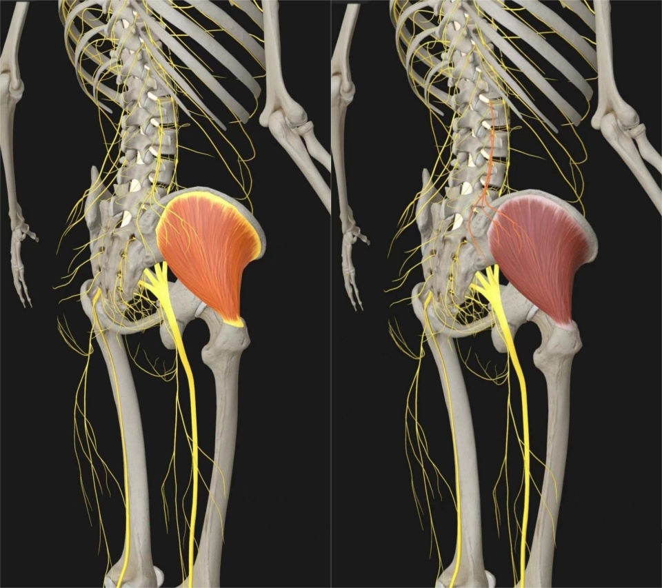 臀部神经图图片