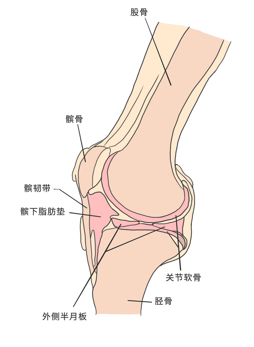 一跑步运动就膝盖痛,很可能是患上了跑步膝!教您正确康复顺序