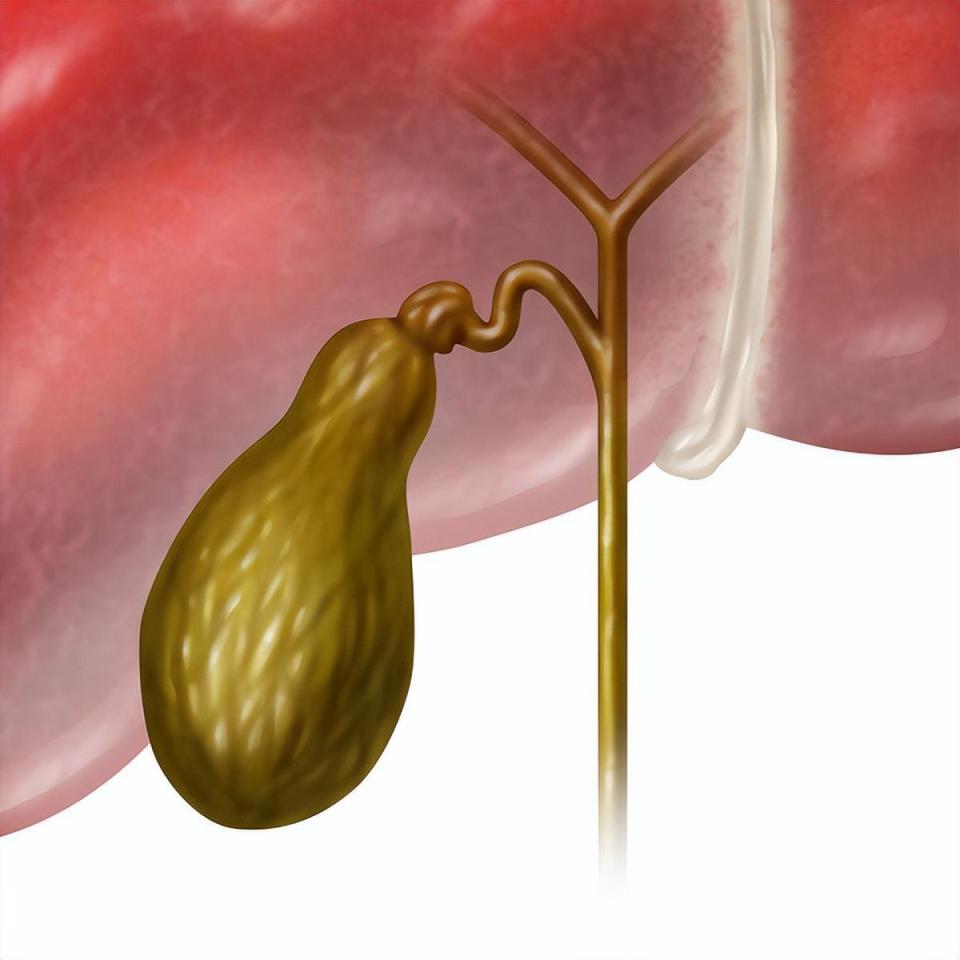 胆囊虽小，对身体危害不小！预防胆囊炎，出现症状，及时就医_腾讯新闻
