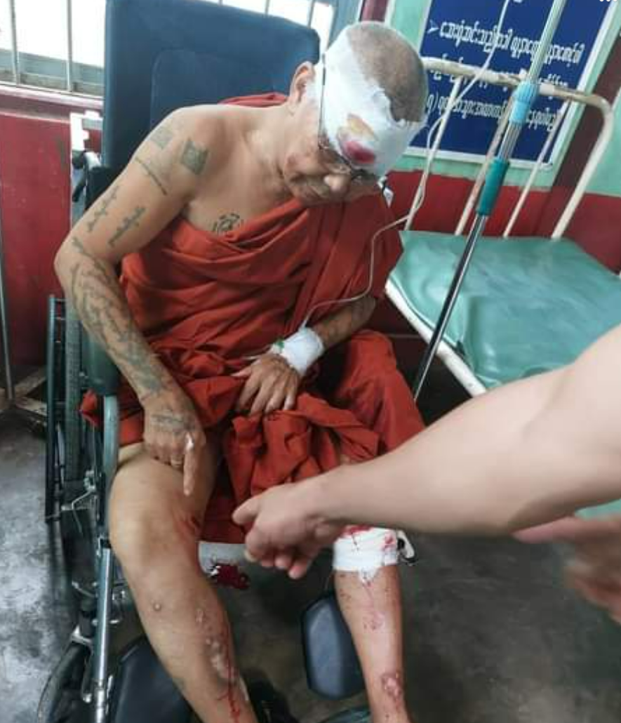 缅北木姐战事"白热化"!炮弹掉进寺院爆炸,大师被弹片打中_腾讯新闻