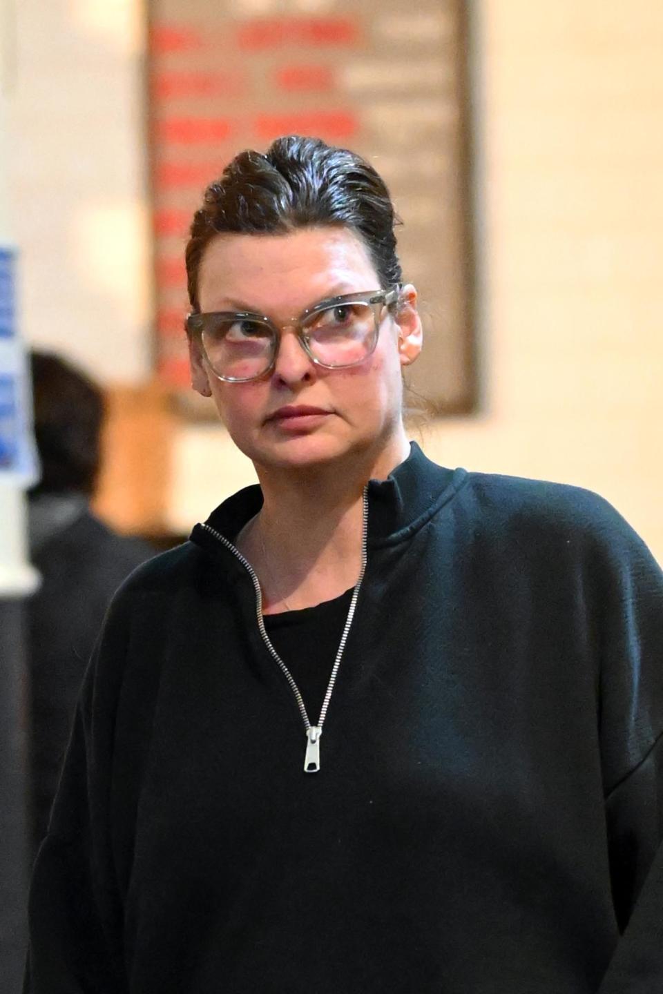 传奇超模琳达·伊万格丽斯塔整形失败导致毁容 坦言"不想再和任何人