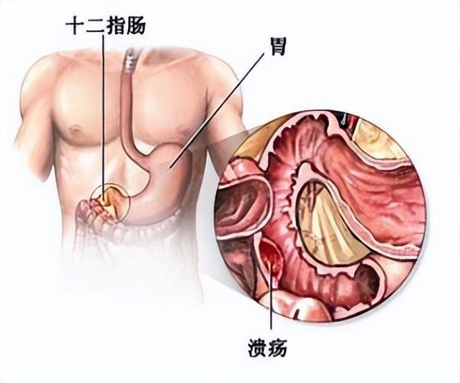 胃痛症状及位置图片