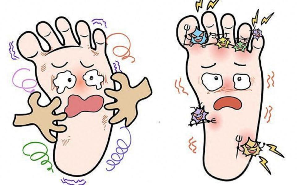 脚气究竟是何方神圣?为什么会选中你?如何防治?