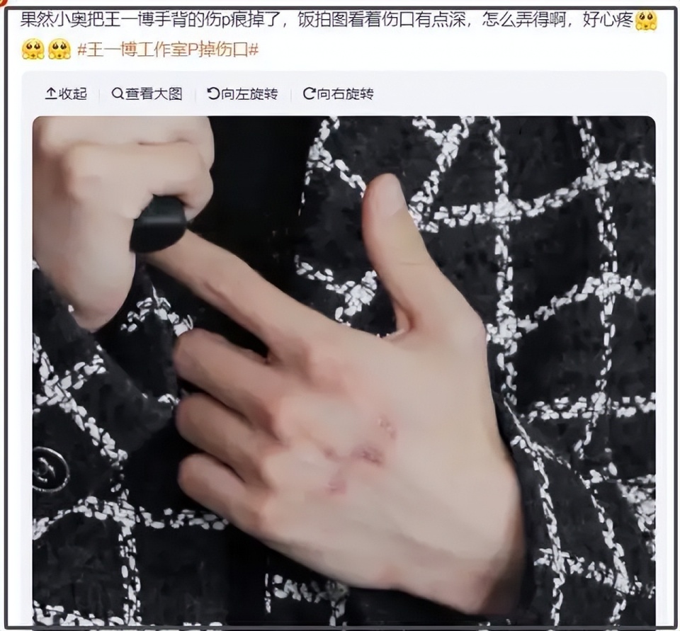 王一博最新露面依旧戴帽子,后脑疑似出现斑秃,国外看球赛散心