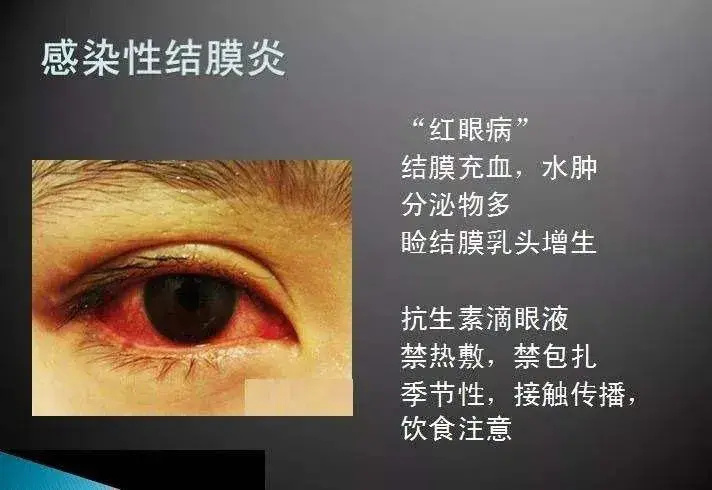 红眼病图片