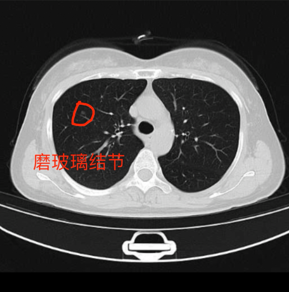 如何有效获取电子版的CT片，方法在这里_腾讯新闻