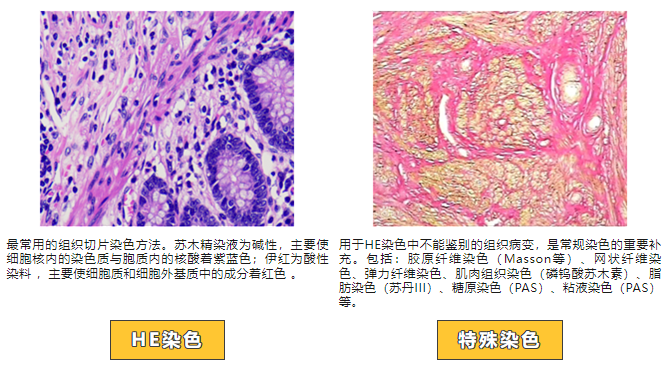 达科为带你揭秘多元病理诊断探索医学世界的奥秘