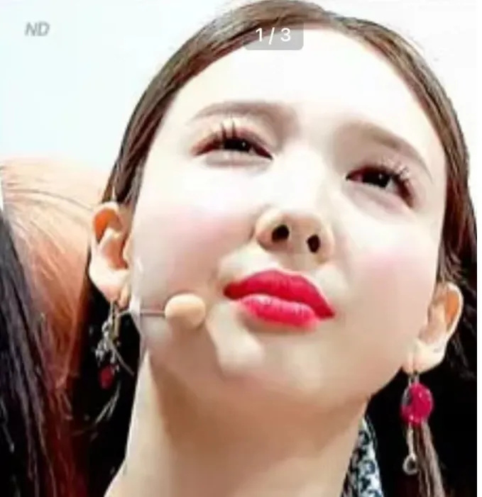 韩星林娜琏脸部肿胀变气球,韩式审美太糟糕,大批偶像