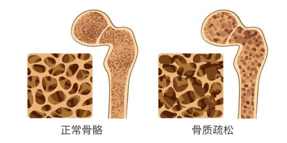 医生解析运动减肥：除了模式，还有时长，到底有多少坑需要绕？图1