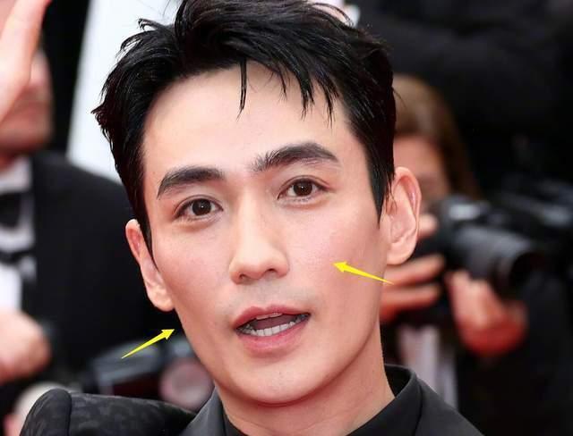 朱一龙戛纳红毯被喷显老他为什么不去做医美