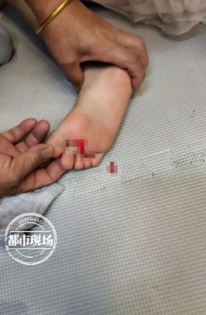 6岁女童在儿童乐园被扎破右脚鲜血直流谁担责
