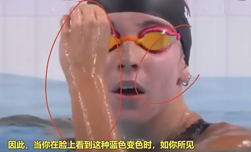 兴奋剂看出图片