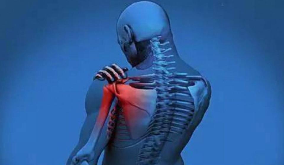 肩周炎到底怎么回事6个治疗方法要知道告别冻结肩