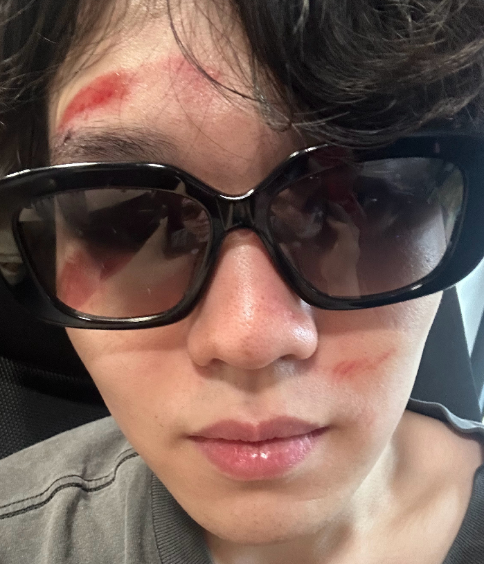 rookie下楼梯摔破相,和小钰情人节约会卡鱼刺_腾讯新闻