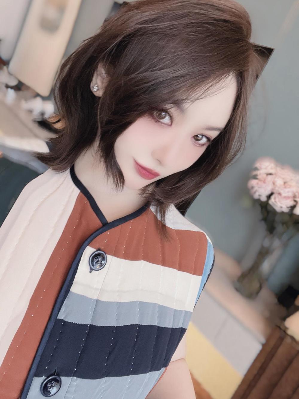 沈腾亲姐沈娜变锥子脸,证实弟弟生病治疗,因修复颈椎久未露面_腾讯