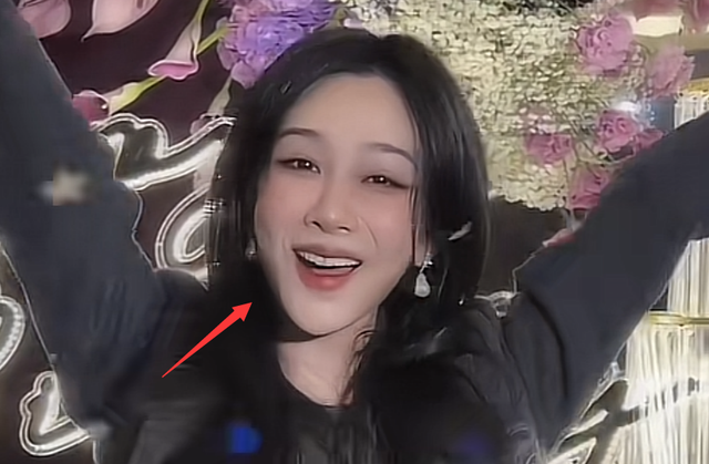 杨紫被质疑整容晒庆生照模样大变满脸通红脸肿僵硬不自然