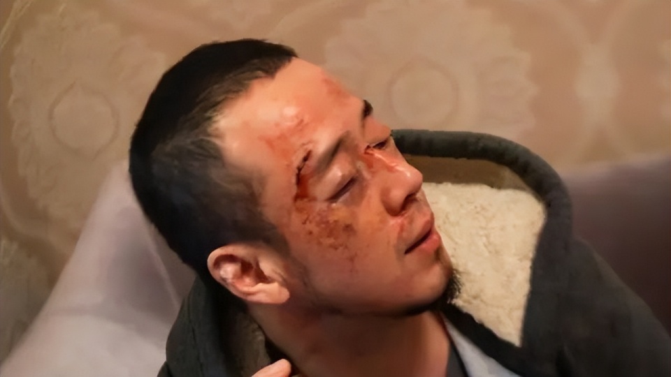 "从网友晒出的照片可以看到,画面中的杨坤可以说是鼻青脸肿,眼眶周围