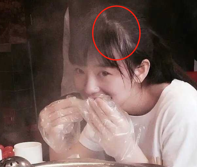 女明星也秃头?杨紫鞠婧祎全靠小心机,杨幂没刘海就是"光明顶"