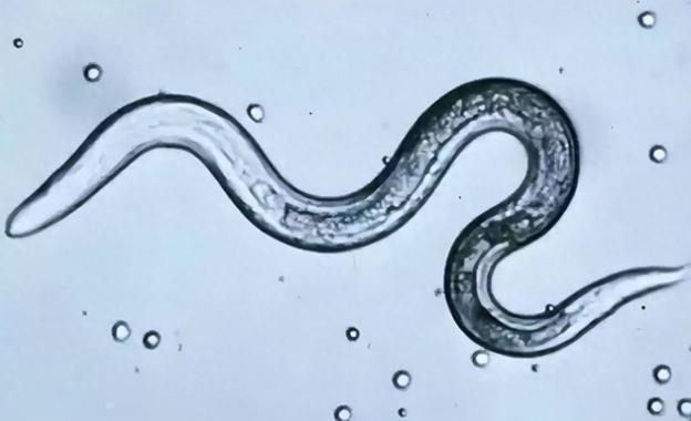 几十年前,几乎人人的肚子里都有蛔虫,怎么现在很少听说了?