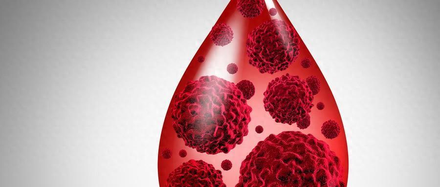 关于血癌你了解多少?它和白血病什么关系?如何治疗?