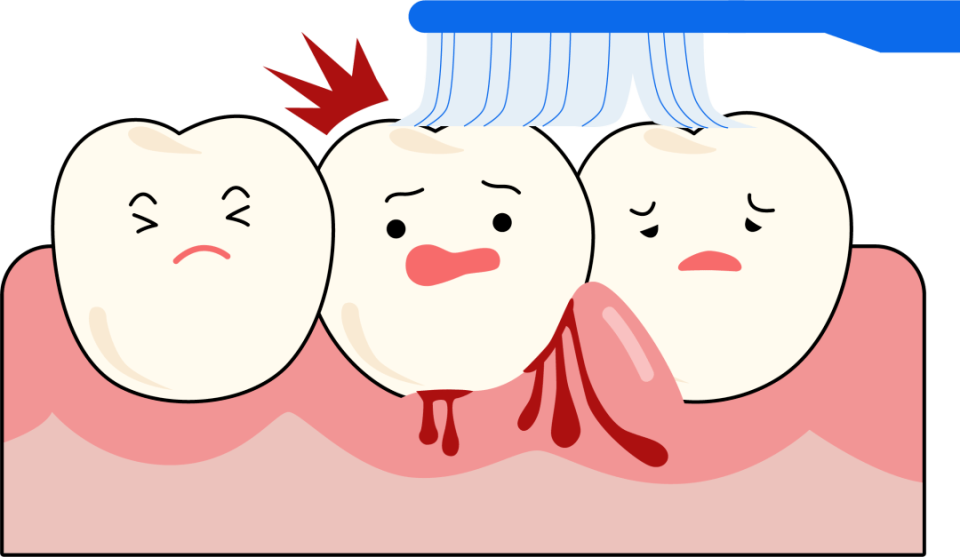 教你7个有效的预防方法!守护口腔健康_腾讯新闻