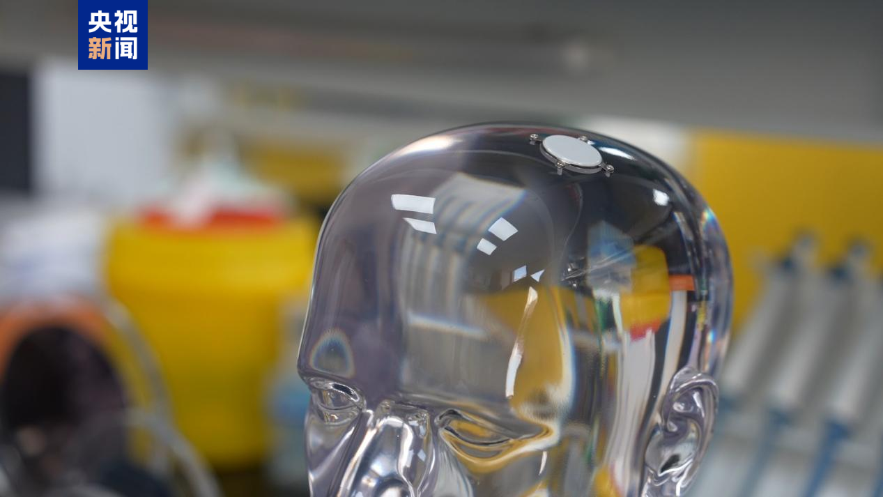 我國侵入式腦機接口臨床試驗取得新進展 - 