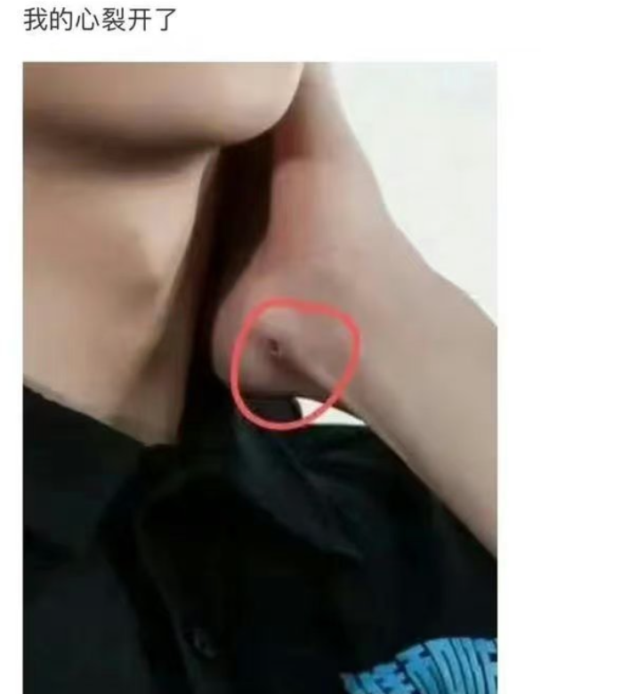 王一博身体状况惹担忧,被发现脱发还长疮,传已经400多天没进组