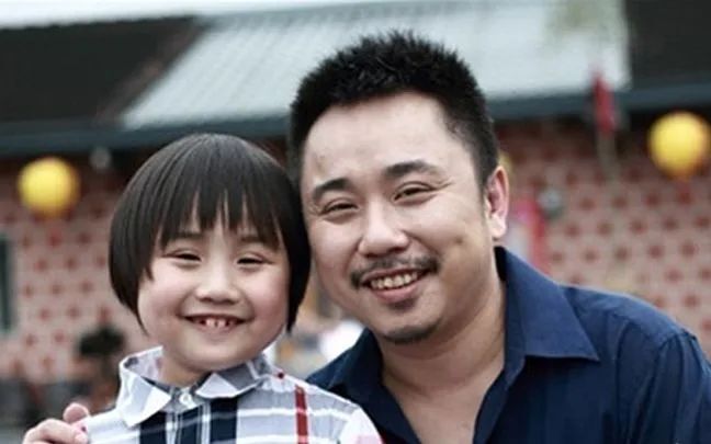 童星小小彬2岁出道养家18岁当清洁工患皮肤病没钱治