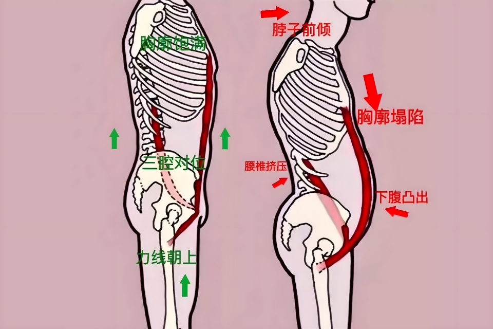 胸廓扁平图片