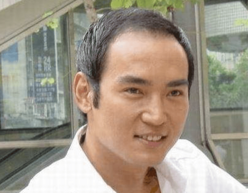 他不止头顶稀疏大片裸露的头皮暴露了颜值的尴尬,更是形成了"地中海"