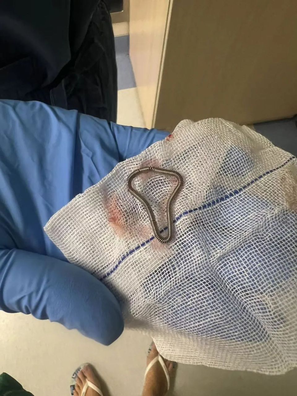 时隔29年,我陪妈妈去取出了"超龄"的节育环