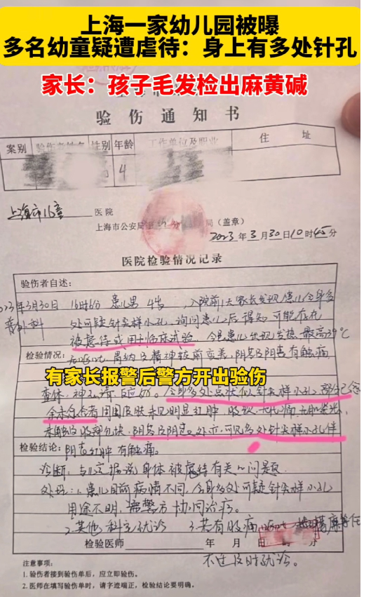 上海一幼儿园多名幼童疑遭虐待，身上多处存在针尖样小孔，结果如何？ 腾讯新闻