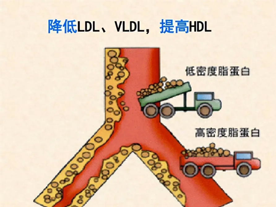 这个残余风险有两个,一是低密度脂蛋白胆固醇,另一个是超敏c反应蛋白.