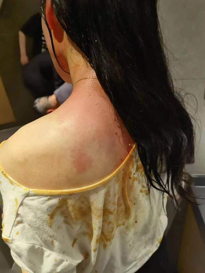 "成都女子两年被家暴16次"离婚纠纷案宣判 法院:准予离婚