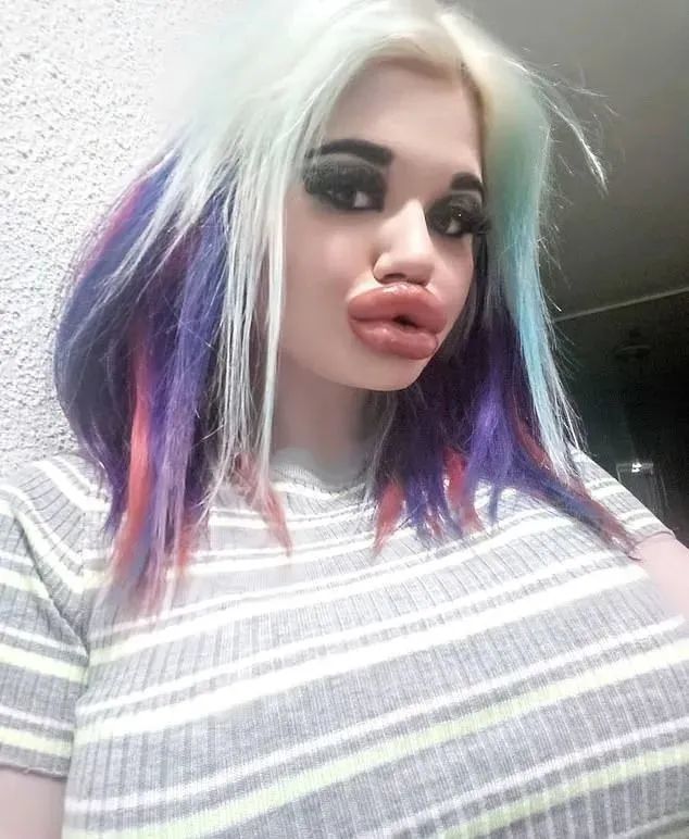 女子痴迷丰唇成为全球嘴唇最厚网红,拍卖自己的厚唇热吻_腾讯新闻