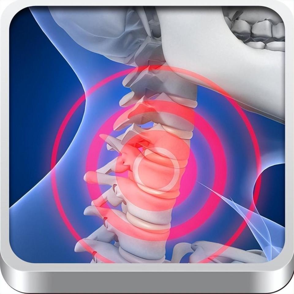 颈椎病分4种认知和治疗误区要知道做好这8点保护颈椎健康