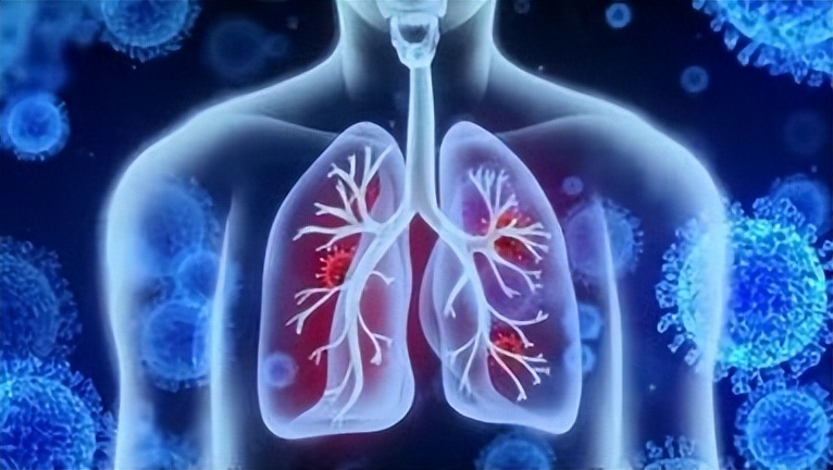 什么是家庭氧疗一口气爬不上三楼？别把喘当成老了，出现5类症状，小心慢阻肺_https://www.jmylbn.com_新闻资讯_第5张