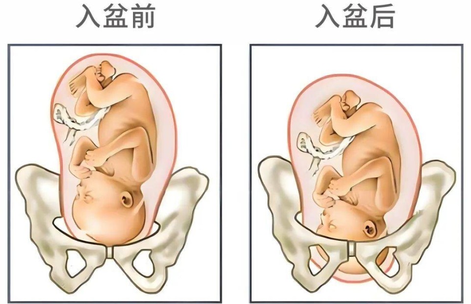 胎儿入盆后，很快就能生了吗？一文带你读懂“入盆”_腾讯新闻