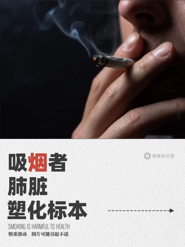 肺癌越来越多,劝你身边的人早点戒烟吧!| 地球知识局