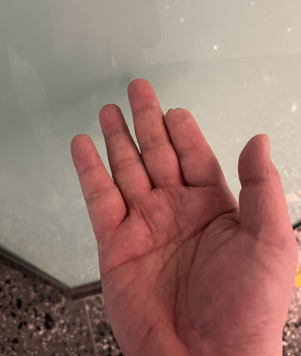 焦健:没这规定吧,我这手曾为国效力_腾讯新闻