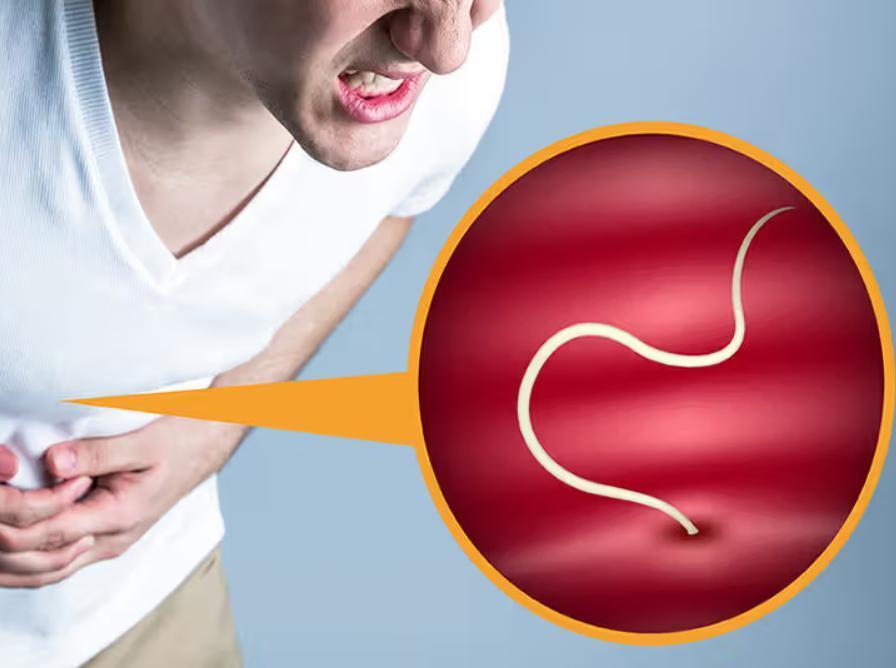 患了蛔虫病的人主要症状就是肚子痛和莫名的肚胀感,这是由于蛔虫成虫