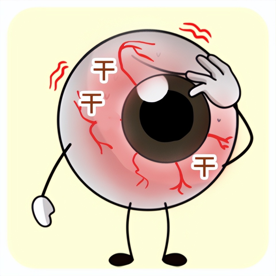 眼睛干涩,疲劳,异物感可能是干眼症在作怪,日常做好7个预防