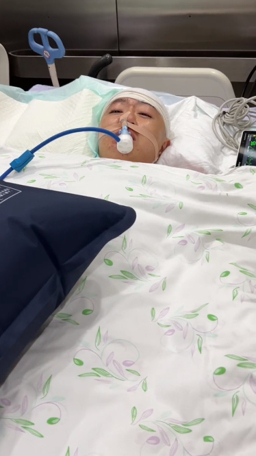 点读机女孩手术成功!历时十二小时,开颅后鼻子插管转特护病房