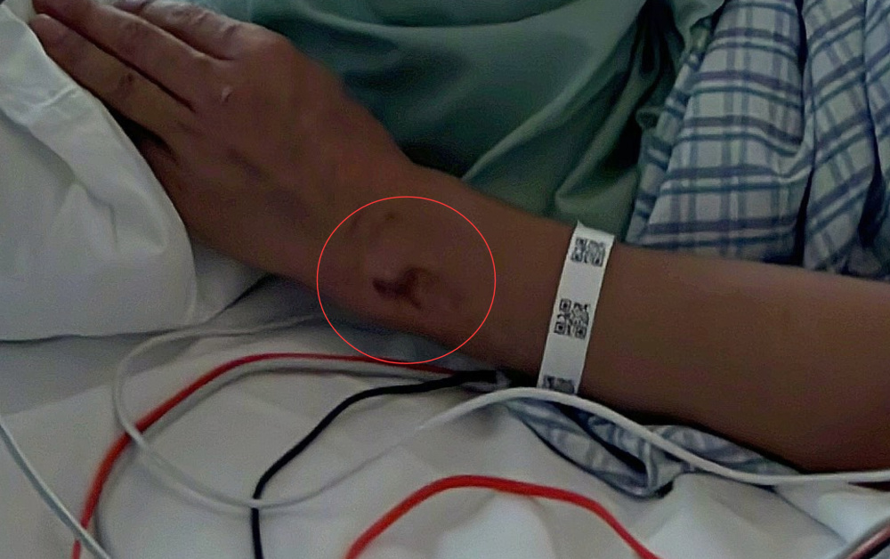 48岁张晋拍动作戏受伤住院,插管吸氧比耶仍乐观,为养三娃太拼命_腾讯