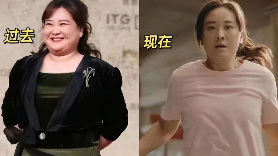 打瘦脸针导致酒窝消失,最瘦时候96斤,贾玲的减肥经历堪称传奇_腾讯