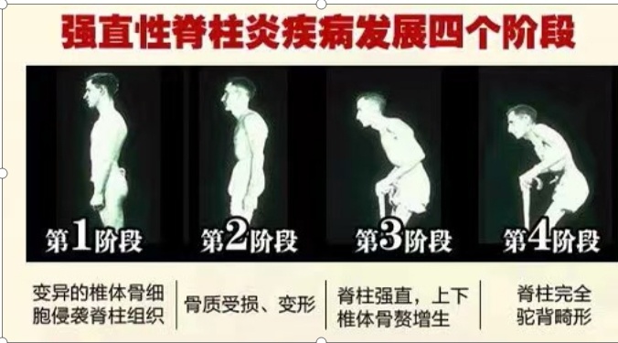 "感谢你们让我挺起脊梁!"_腾讯新闻