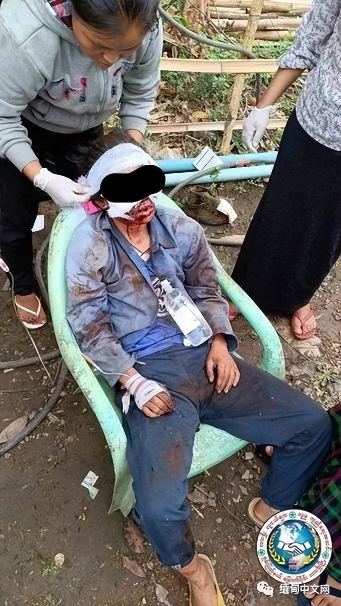 缅甸1名清理耕地的男性误碰地雷被炸伤,伤势严重