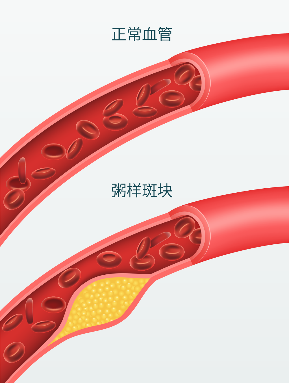 别再给人生添堵，国人心血管病数据分析报告_腾讯新闻