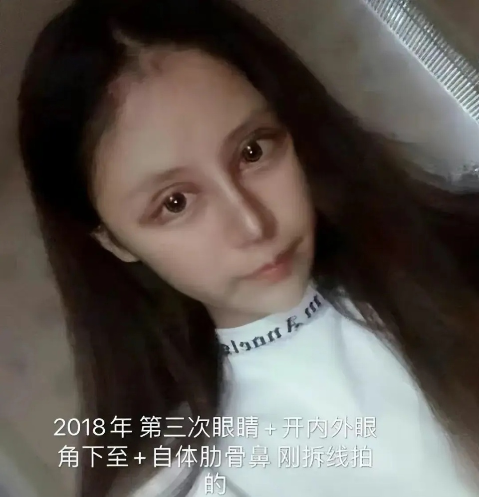 641